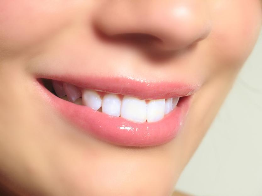 Đối tượng nên bọc răng sứ thẩm mỹ?